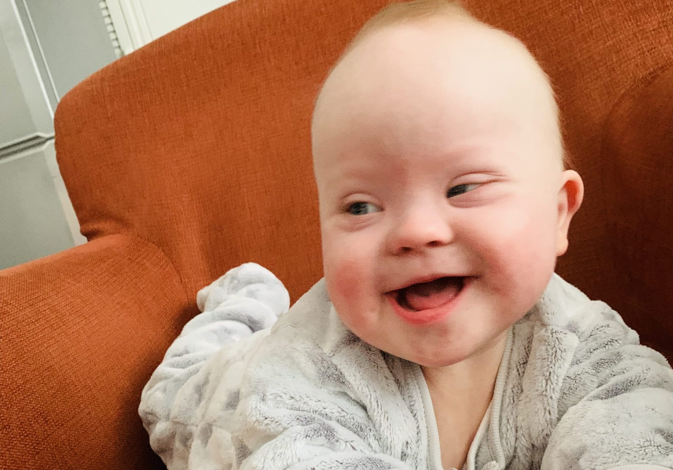Baby with down syndrome is lying on their front on a settee. They have their arms out in front of them and are looking to the side smiling