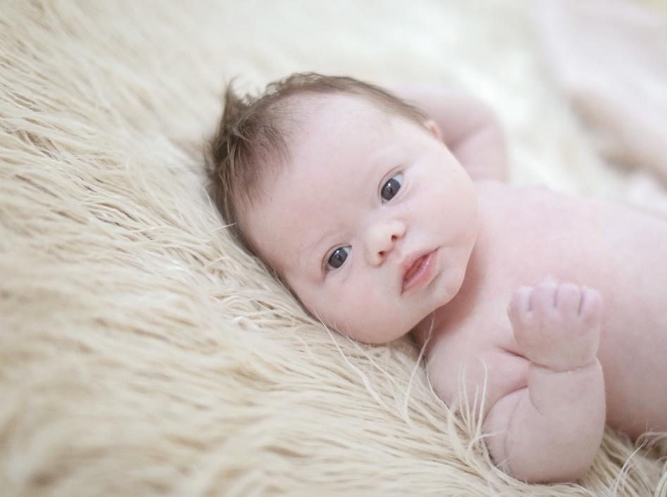 Baby with down syndrome is lying on a fluffy rug